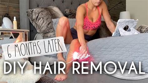 Ipl Hair Removal At Home 6 Months Later Youtube