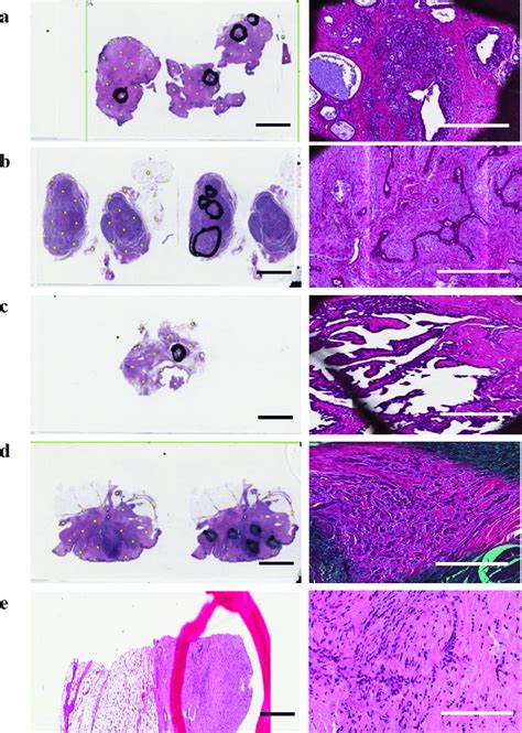 Digital Pathology Scan Of H E Stained Tissue Section Left And