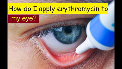 How Do I Apply Erythromycin To My Eye Youtube