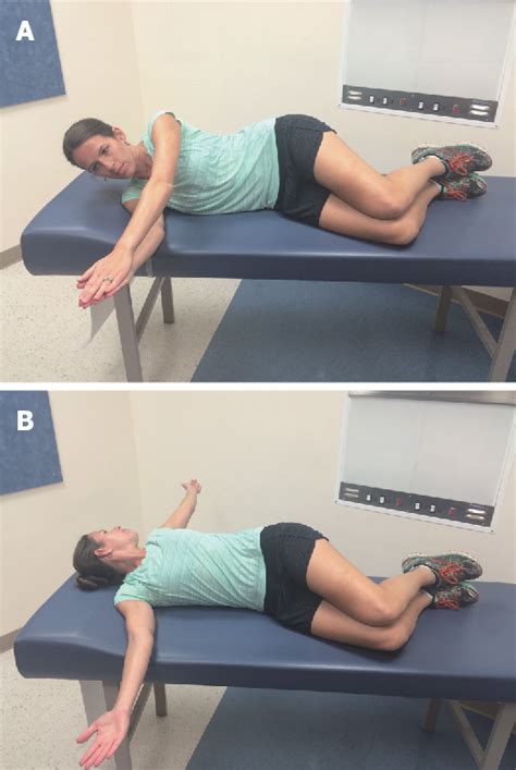 Figure 3 From Elbow Ulnar Collateral Ligament Injuries In Athletes Can We Improve Our Outcomes