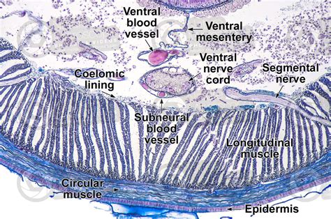 Lumbricus sp. Earthworm. Lumbricidae. Transverse section. 125X ...