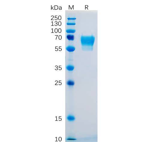 Human CD27 Protein hFc Tag 专注肿瘤免疫