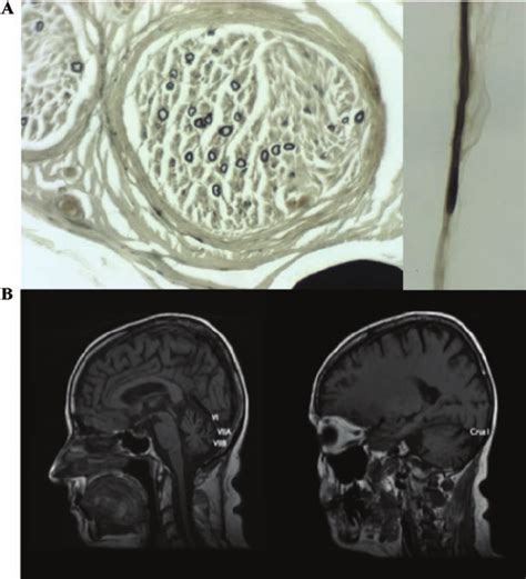 A Paraffin Embedded Nerve Fascicle 400 Magnification And