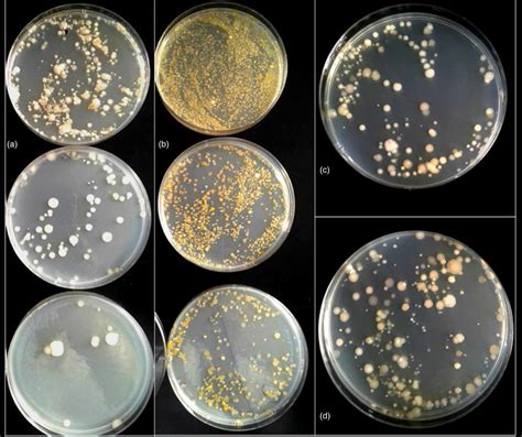 Colonies Of Heterotrophic Bacteria Grown On Nutrient Agar Plates 25