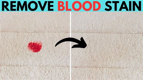 Best Way To Remove Dried Blood Stains From Carpet YouTube