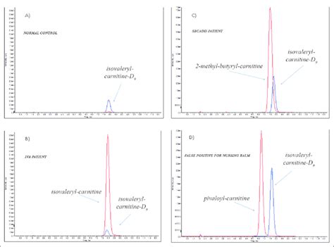 Extracted Ion Chromatogram Of The Monitored Mass Transitions 30285 Mz Download Scientific