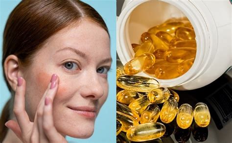 Vaselina Limón Y Vitamina E Ingredientes Ideales Para Un Rostro De