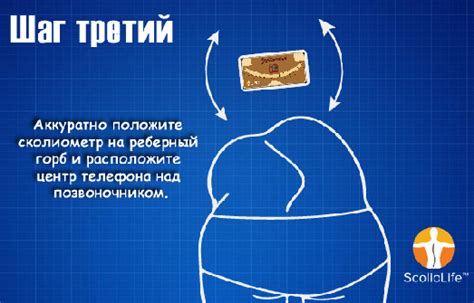 ГЛАВНАЯ | Scoliometer