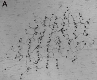 brain bits  brains explained