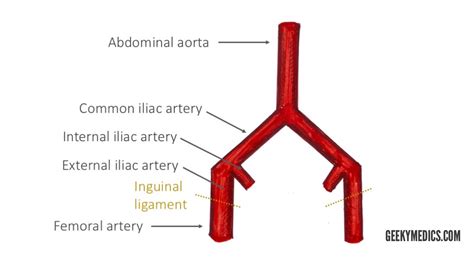 Internal Iliac Artery Anatomy Anatomical Charts Posters