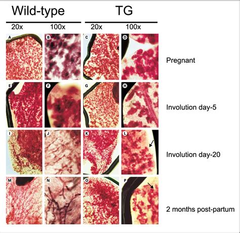 Figure 1 From Targeted Expression Of Activated Rac3 In Mammary