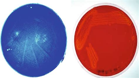 Metagenomic Library Constructed From The DNA Extracted By The Protocol