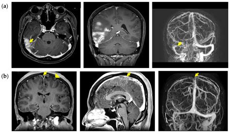 JCM Free Full Text Clinical Characteristics And Prognostic Factors