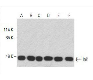 Ini1抗体 A 5 SCBT Santa Cruz Biotechnology