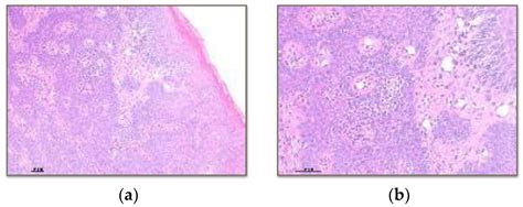 Polymers Free Full Text Behaviour Of The Peri Implant Soft Tissue With Different