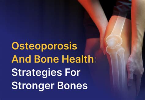 Osteoporosis And Bone Health Strategies For Stronger Bones Smf