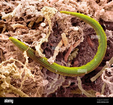 Nematode Worm Coloured Scanning Electron Micrograph Sem Of A