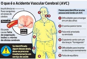 Como Prevenir O Avc Fisioterapia Oeiras