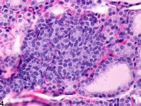 Thyroid gland - C Cell Hyperplasia - Nonneoplastic Lesion Atlas