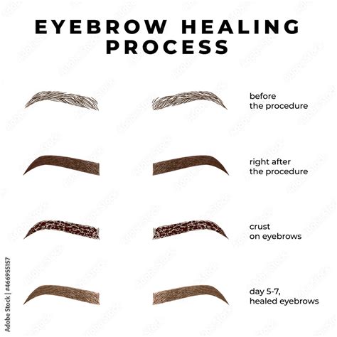 Eyebrows healing process after microblading. Healing stages eyebrows ...