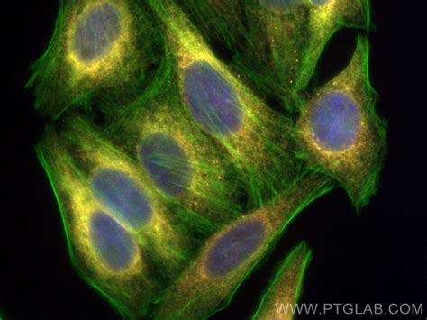 Calreticulin Antibody Cl555 27298 Proteintech