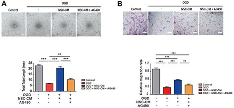 Jak Stat Pathway Mediates Neuroprotective And Pro Angiogenic