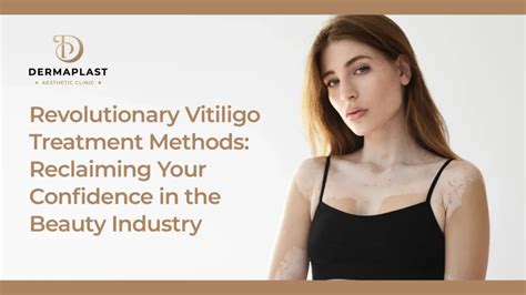 Revolutionary Vitiligo Treatment Methods: Reclaiming Your Confidence in the Beauty Industry ...