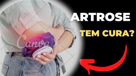 Artrose Tem Cura Youtube