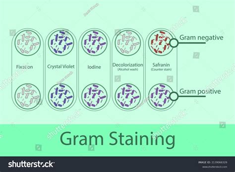 Diagram Showing Gram Staining Technique Steps Stock Vector Royalty