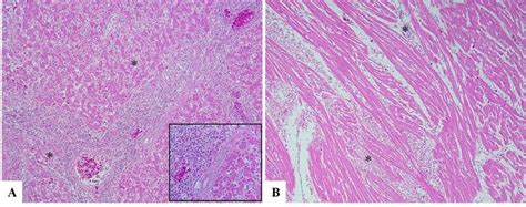 Histopathological Lesions Of Fowl Typhoid And Pullorum Disease In Download Scientific Diagram