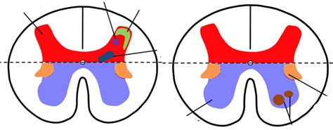 Bios Gray Matter Nuclei Diagram Quizlet