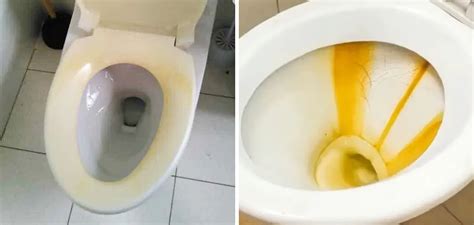 How To Remove Yellow Stains From Toilet Seat 6 Easy Steps