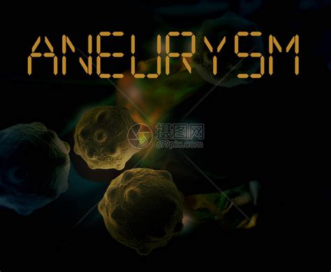 脑动脉瘤的3d医学插图高清图片下载 正版图片507452504 摄图网