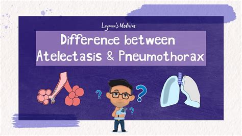 Atelectasis Vs Pneumothorax Atelectasis Pneumothorax Youtube