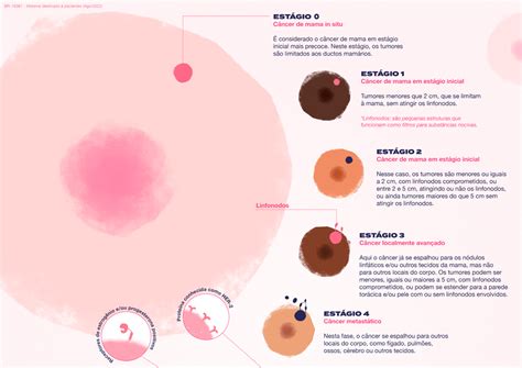 FazBem Blog Câncer de mama diagnóstico estadiamento e subtipos