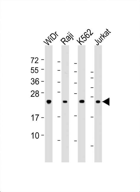 Rabbit Anti Ctla Polyclonal Antibody N Term Absin Univ