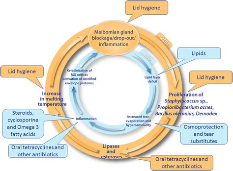 Revisiting The Vicious Circle Of Dry Eye Disease A Focus On The