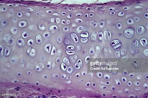 Hyaline Cartilage Connective Tissue Photos And Premium High Res