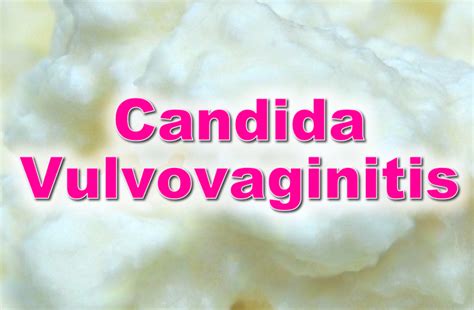 Candida Vulvovaginitis Pictures Photos