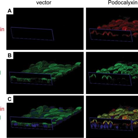 Podocalyxin Induces Apical Expansion And Recruits Nherf To The Apical