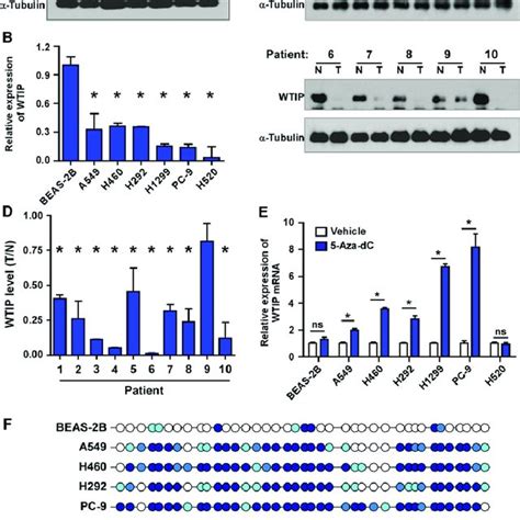 Promoter Methylation Leads To WTIP Downregulation In NSCLC Western