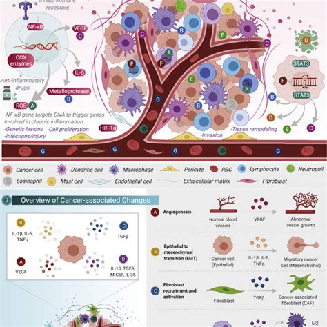 Systemic Chronic Inflammation And Cancer Progression 1 Different