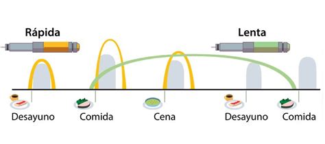 Caracter Sticas Y Tipos De Insulina Basal Esperanza En Diabetes