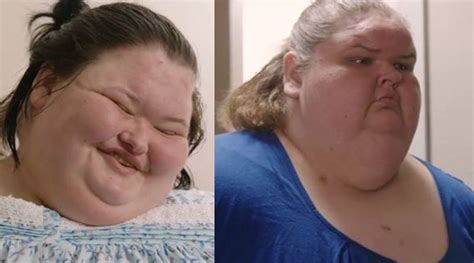 '1000-Lb. Sisters': Amy Recovers From Surgery, Tammy Supports Her