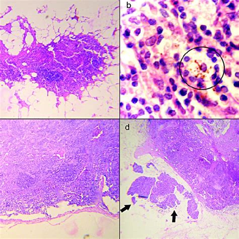 Microscopic photograph of autoimplanted splenic tissue (H&E). a ...