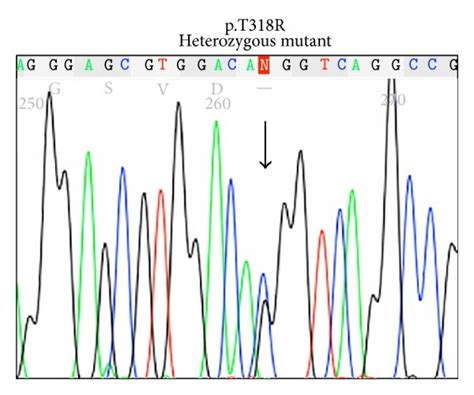 Sequencing Electropherograms Showing Cyp B Mutations In Patient