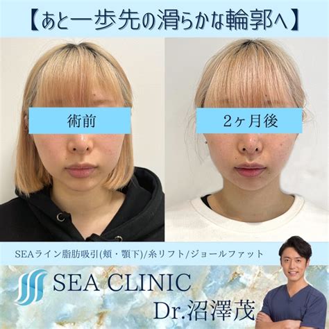 あと一歩先の滑らかな輪郭へ Sea Clinic −シークリニック 銀座― 理想を叶える小顔治療