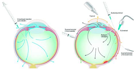 Schematic Displaying Intraocular Distribution And Elimination Pathways Download Scientific