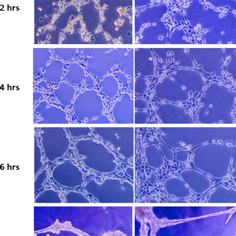 The Effect Of Cell Number On Endothelial Cell Tube Formation 3b 11