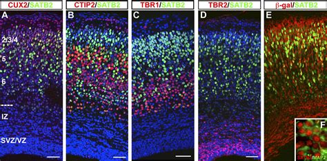 Satb2 Regulates Callosal Projection Neuron Identity In The Developing